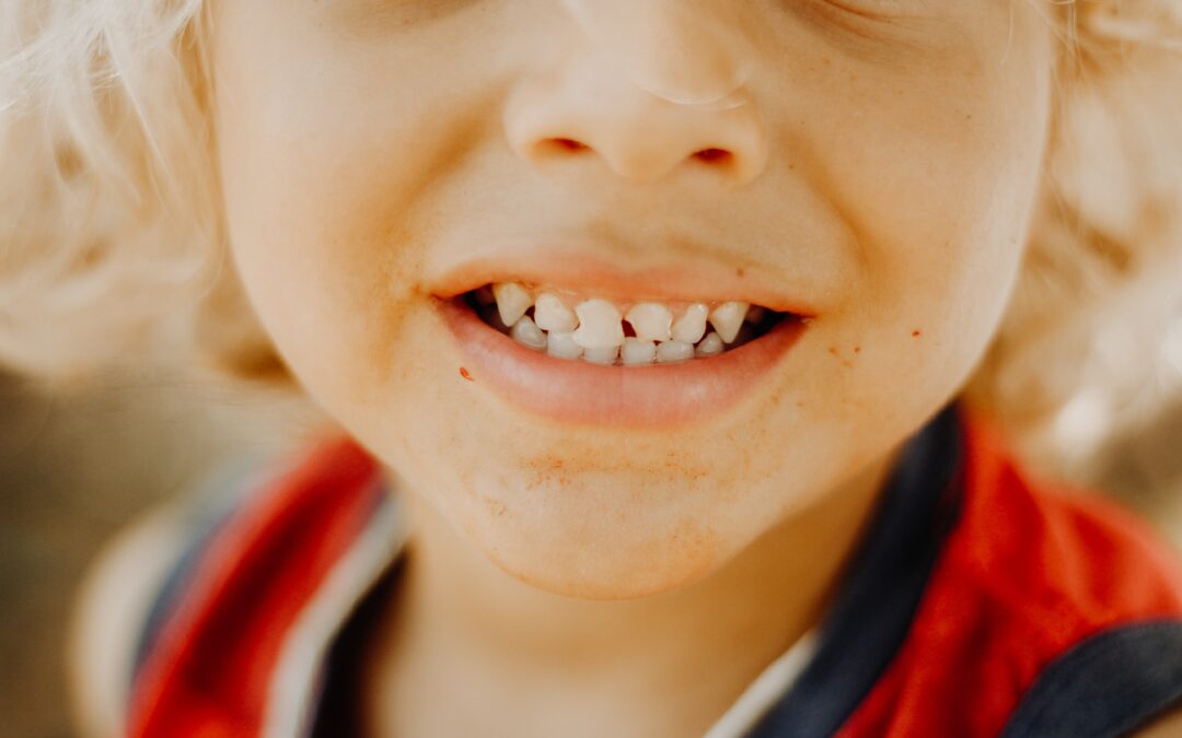 Tips to Keep Your Child from Getting Cavities