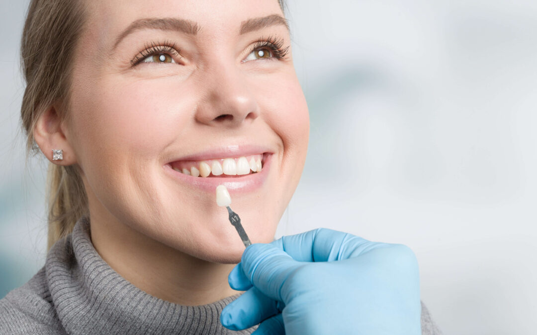 What Are Veneers and How Long Do Dental Veneers Last?